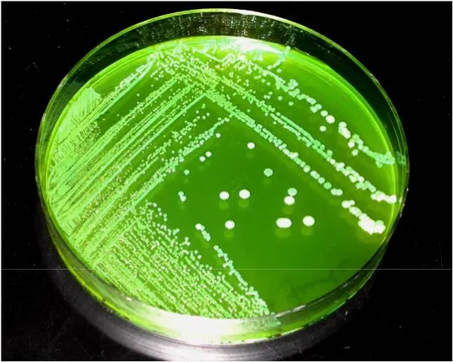 Brilliant Green Agar Plates