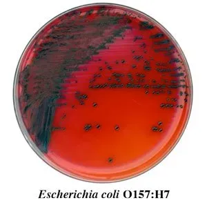 Chromogenic E. coli Medium