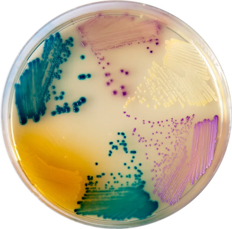 Chromogenic Urine Medium