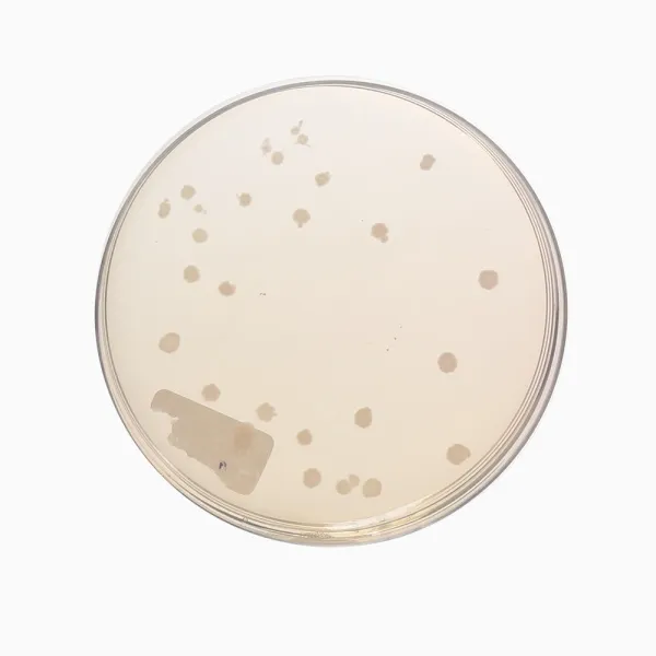Brewer Anaerobic Agar