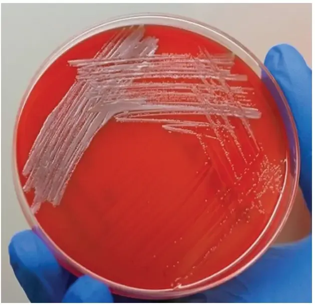 Brucella Blood Agar